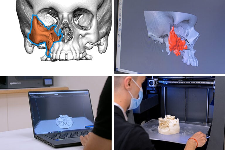 anatomický 3D model 3D tisk na BCN3D Epsilon W50