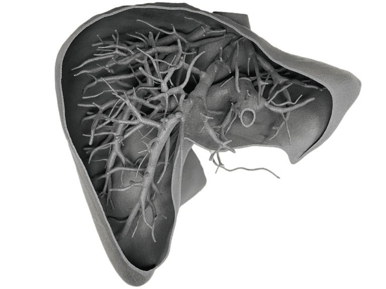 3D tisk modelů orgánů v IKEM