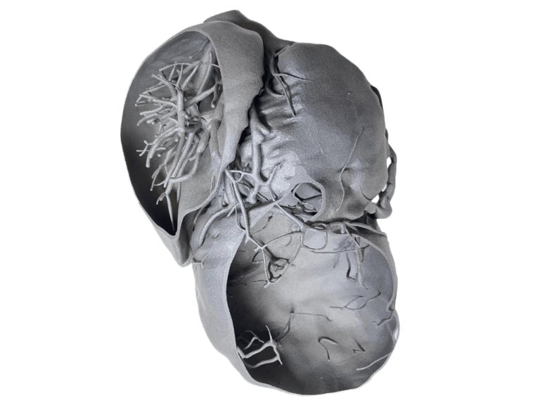 3D tisk modelů orgánů v IKEM